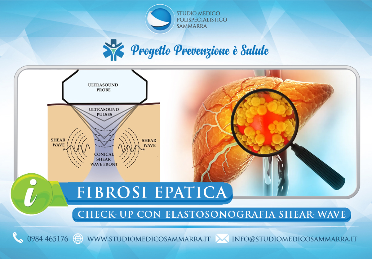 Fibrosi Epatica: valutazione mediante Elastosonografia Shear-Wave a Cosenza e Rende